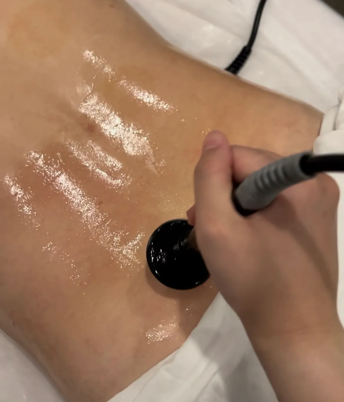 High frequency ultrasound